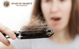 Làm thế nào để chữa rụng tóc quá nhiều ở nữ giới hiệu quả?