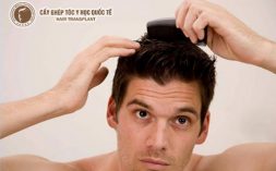 Cách khắc phục tóc dầu ở nam giới an toàn hiệu quả cao 