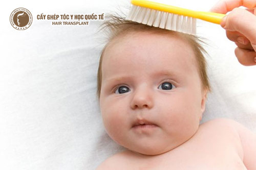 Rụng tóc máu ở trẻ sơ sinh và những lưu ý không thể bỏ qua