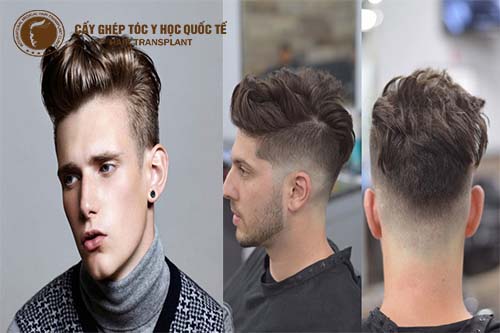 Đầu hói để kiểu tóc gì cho hợp