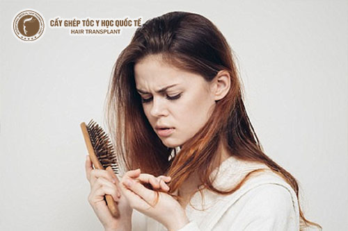 Rụng tóc mỗi ngày chớ nên xem thường