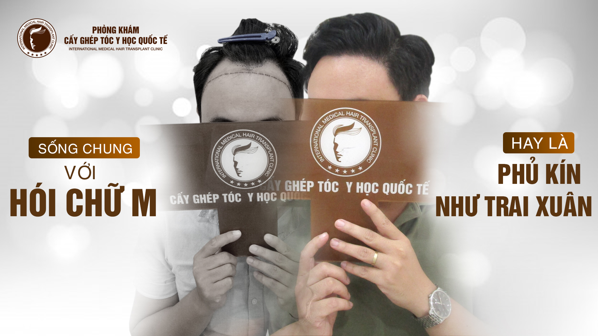 Cấy tóc tự thân đã được chứng minh hiệu quả trên toàn thế giới Cấy tóc tự thân đã được chứng minh hiệu quả trên toàn thế giới