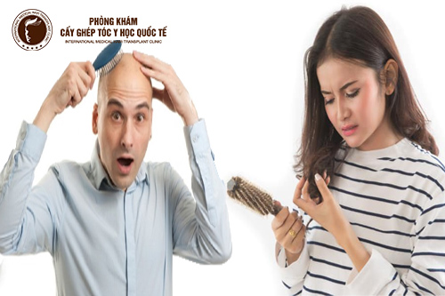 3 cách trị hói đầu, rụng tóc ở nam và nữ giới hiệu quả ai cũng cần biết