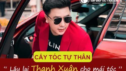 Những điều cần biết về cấy tóc: giải pháp số 1 cho rụng tóc, hói đầu