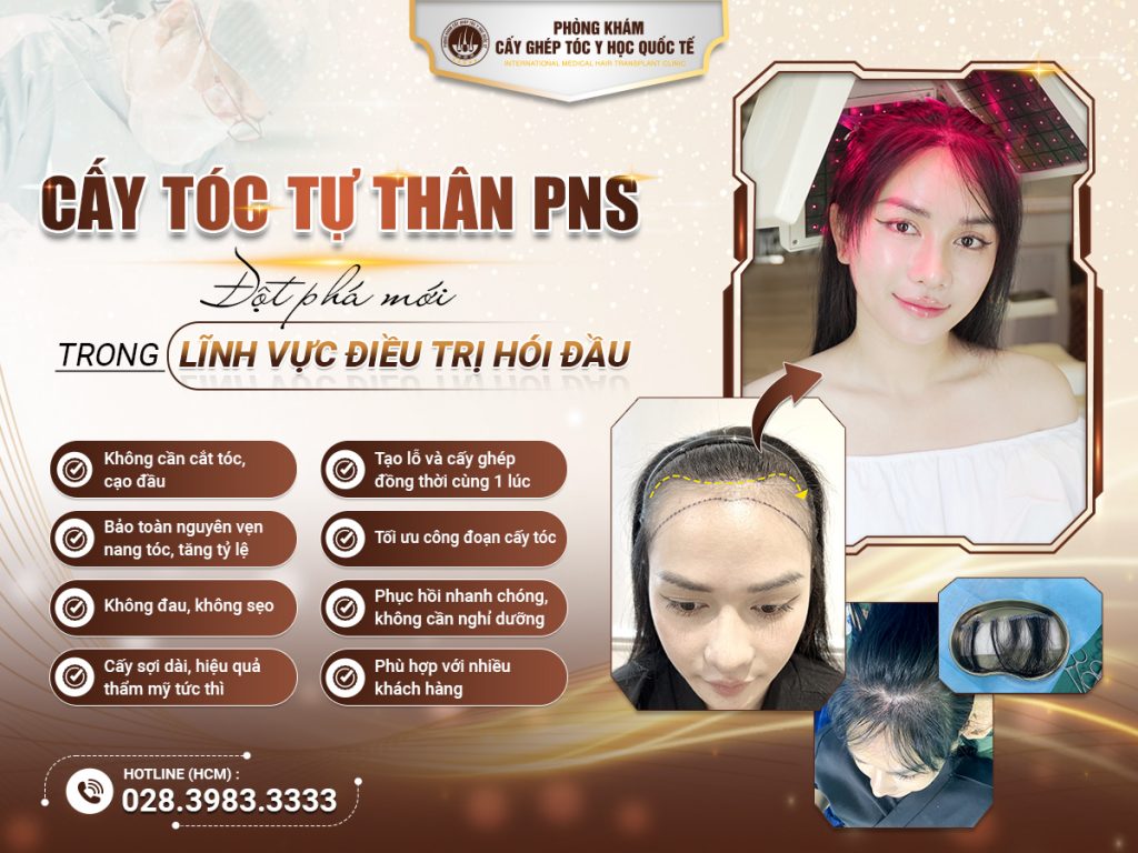 cay-toc-pns