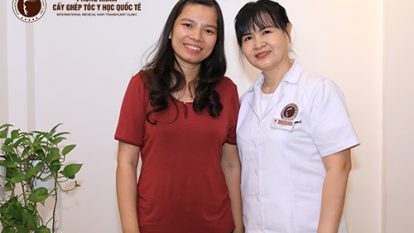 Trút bỏ gánh nặng tâm lý sau hơn 20 năm sống chung với ám ảnh sẹo da đầu