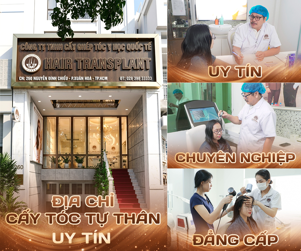 phòng khám cấy tóc