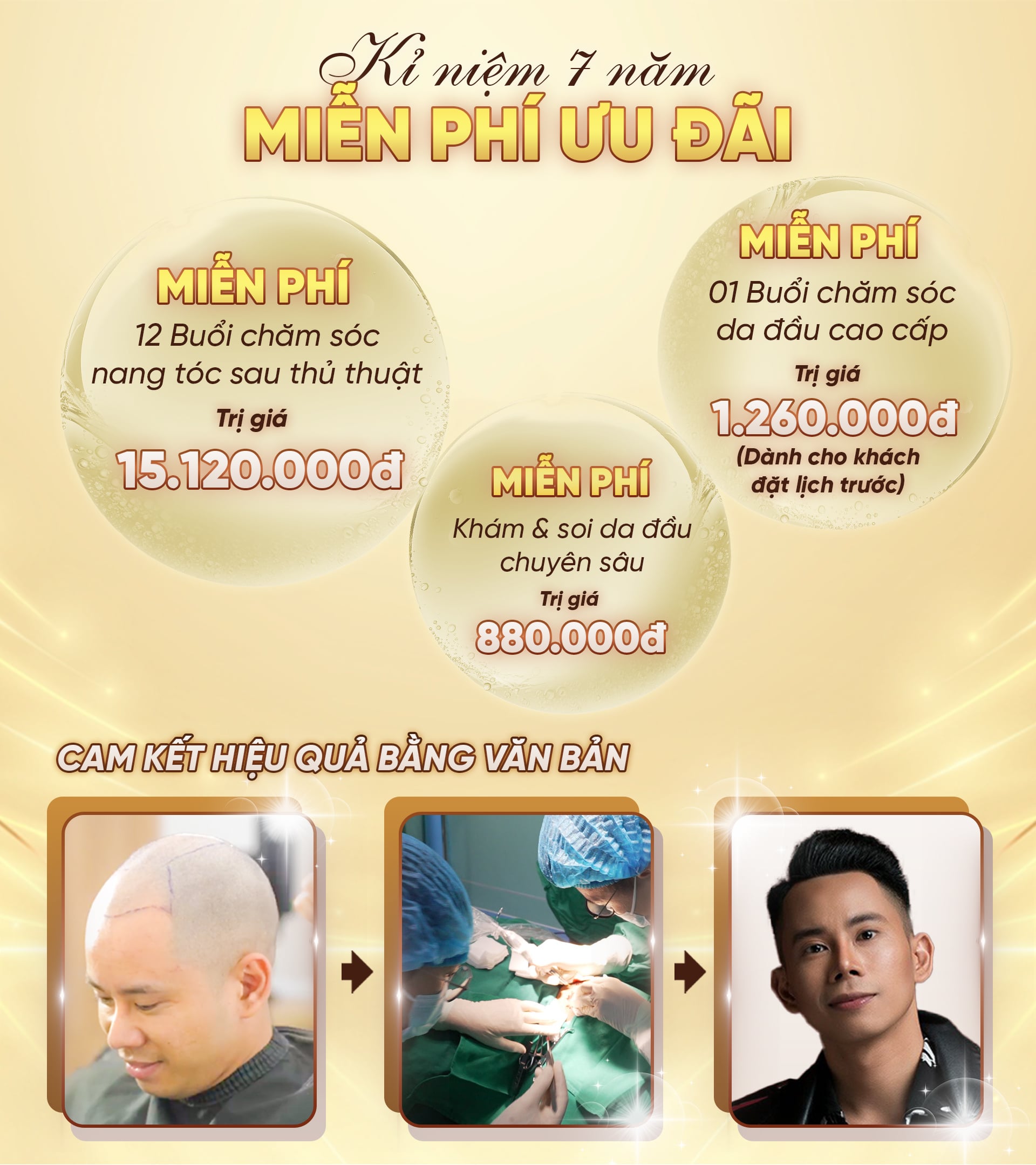 Cấy ghép tóc y học