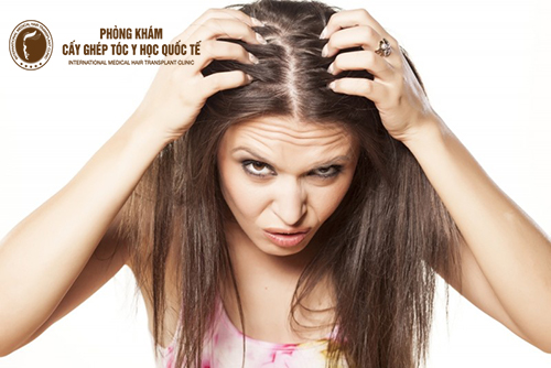 Nguyên nhân và cách chữa trị bệnh lý rụng tóc đau da đầu