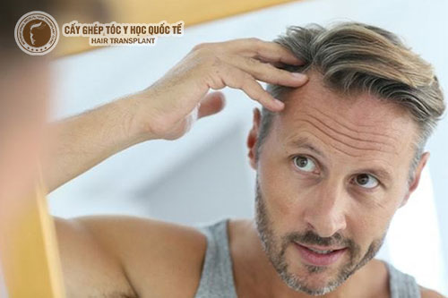 Làm thế nào để khắc phục tình trạng rụng tóc con?