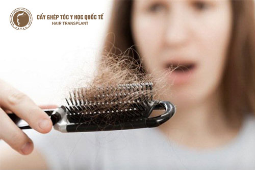 Phương pháp nào khắc phục được tình trạng rụng tóc không sẹo?