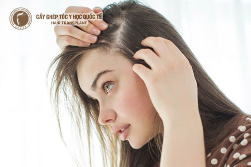Cách trị rụng tóc ở tuổi dậy thì an toàn và hiệu quả