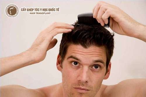 Cách khắc phục tóc dầu ở nam giới an toàn hiệu quả cao 