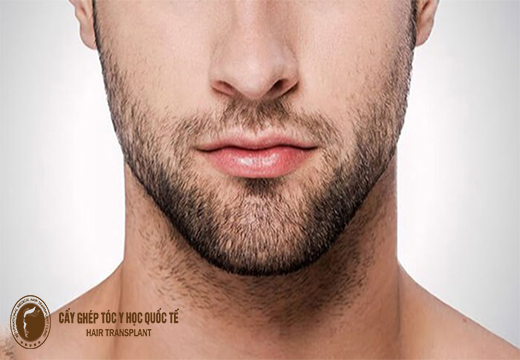 Cách để râu quai nón đẹp dành cho nam giới