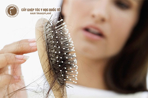 Thuốc Đông y điều trị rụng tóc có tốt không?