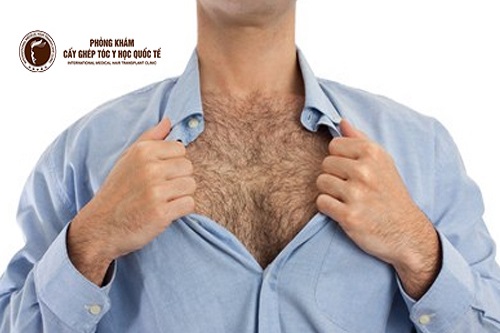 Lông ngực có tạo nên nét quyễn rũ của đàn ông?