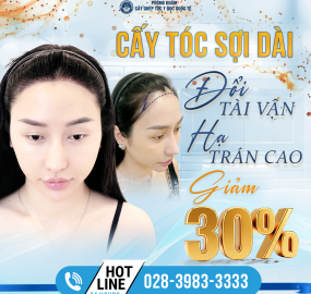 Cấy tóc hạ đường chân tóc: Giải pháp an toàn khắc phục trán cao